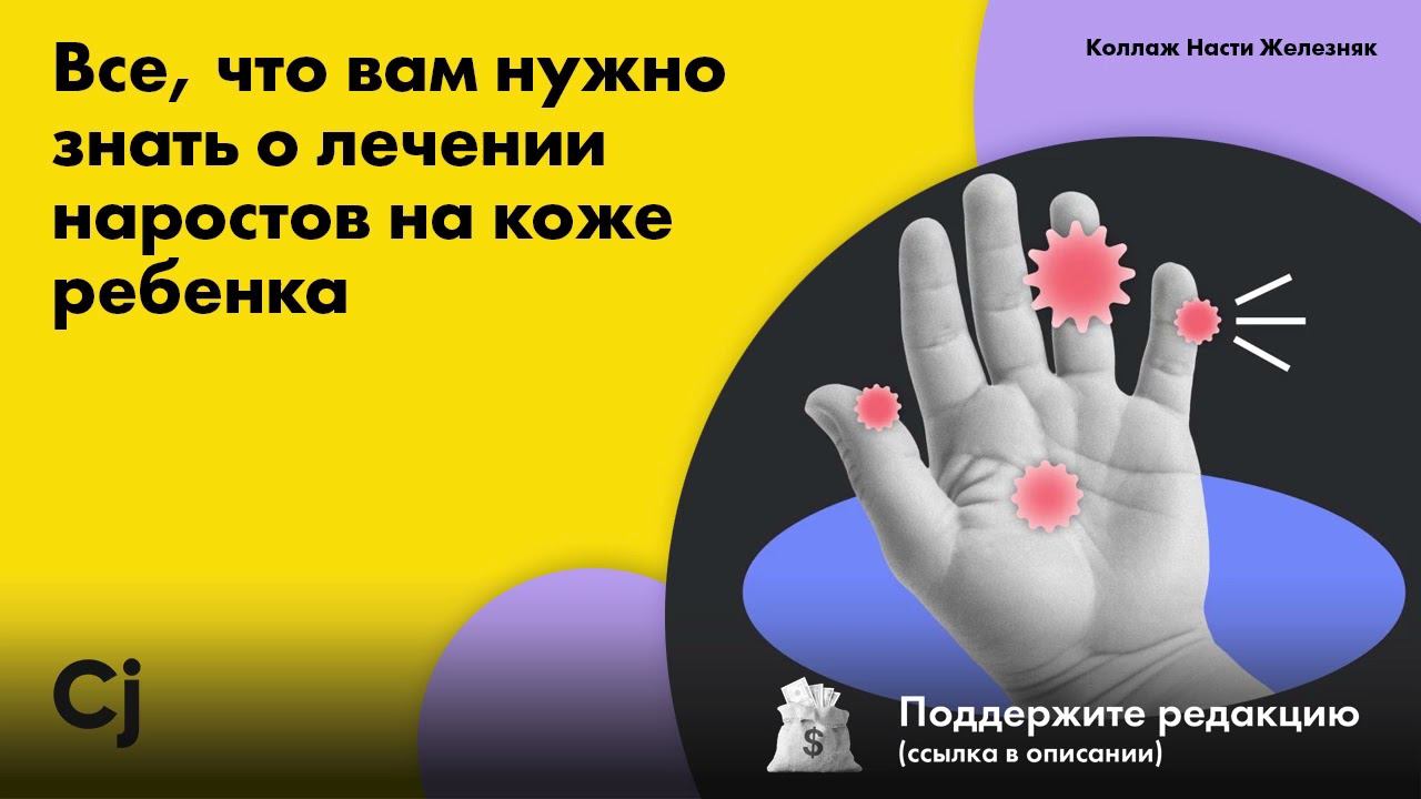 Все, что вам нужно знать о лечении наростов на коже ребенка смотреть онлайн