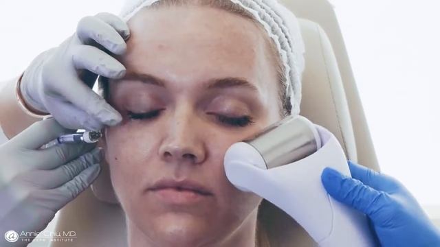 Best Treatment for Dark Circles - Undereye Filler смотреть онлайн