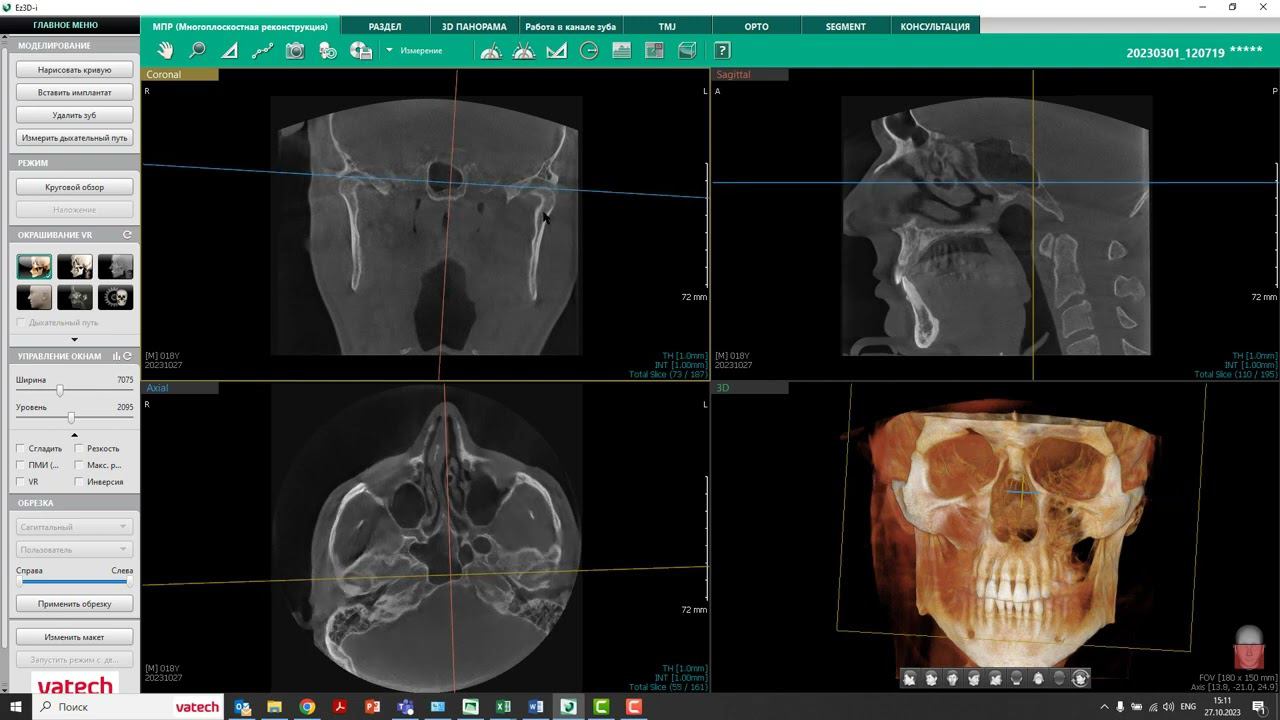 Поворот объема в программе Ez3D i смотреть онлайн