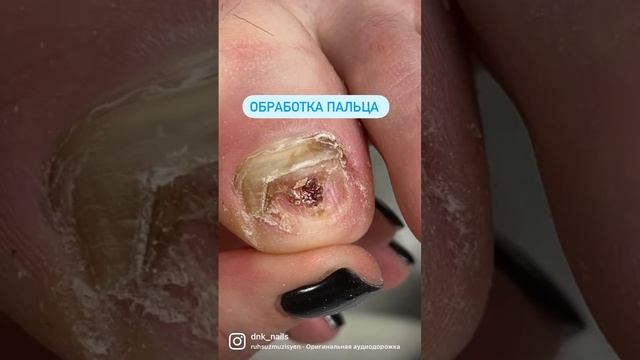 @dnk_nails #педикюркоптево #коптево #педикюр #подолог смотреть онлайн
