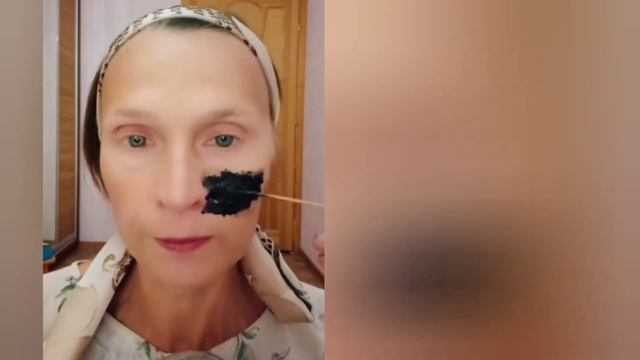 ЧЕРНАЯ маска от ЧЕРНЫХ ТОЧЕК! Уберет любые ПИГМЕНТНЫЕ пятна, ПРЫЩИ, воспаления, РАСШИРЕННЫЕ поры смотреть онлайн