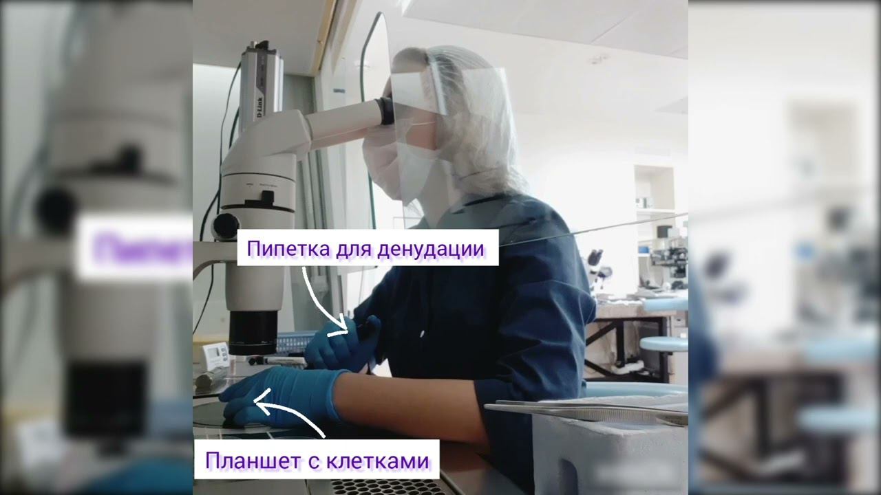 Ооцит после эко смотреть онлайн
