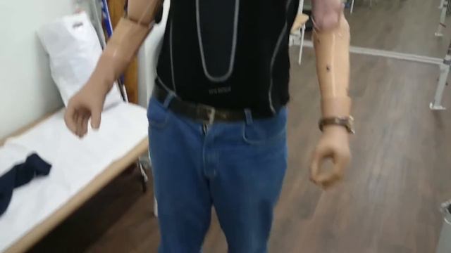 Мутин Алексей, парная ампутация верхних конечностей. Биоэлектрические протезы верхних конечностей. смотреть онлайн