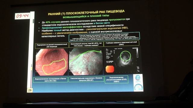 4 Сухин Д.Г. Пирогов С.С. Редкие заболевания пищевода: эндоскопическая диагностика и лечение