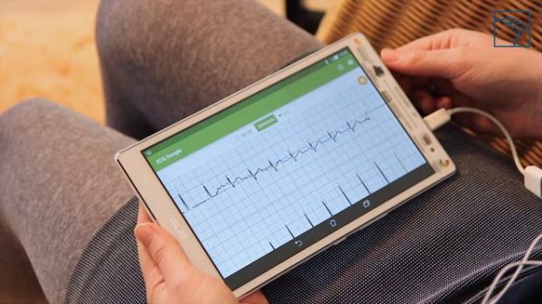 Видеообзор кардиокомплекса ECG Dongle