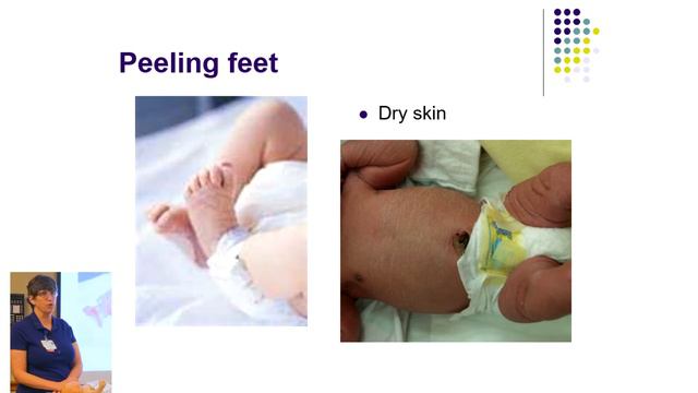 OGH Prepared Childbirth - Newborns смотреть онлайн