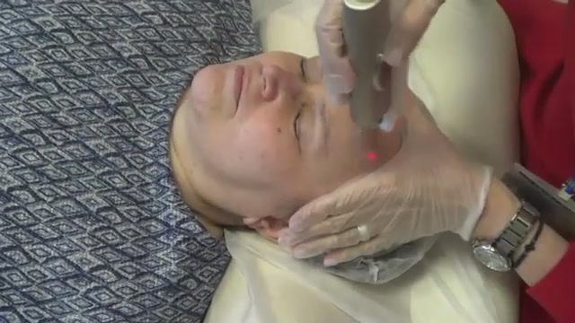 Лечение сосудистых патологий лазером Fotona смотреть онлайн