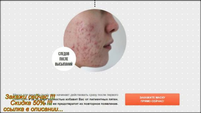 Как избавиться от пигментных пятен