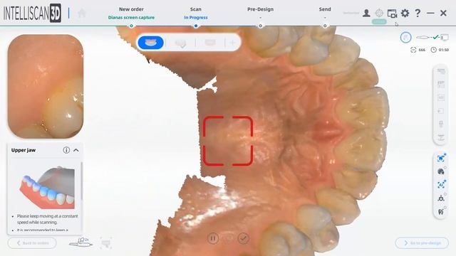 Intelliscan 3D How to Scan a Dynamic bite смотреть онлайн