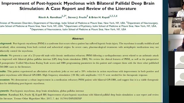 Deep Brain Stimulation For Treatment Of Myoclonus (short Review)