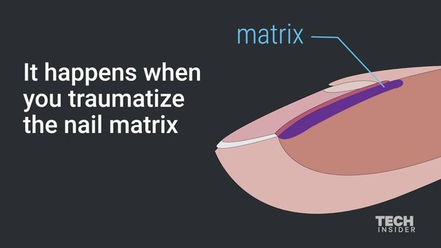 What white marks on nails mean about health смотреть онлайн