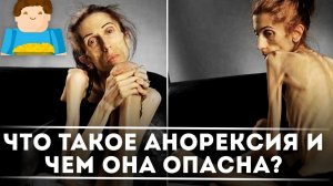Что такое анорексия и чем она так опасна? [Plushkin]