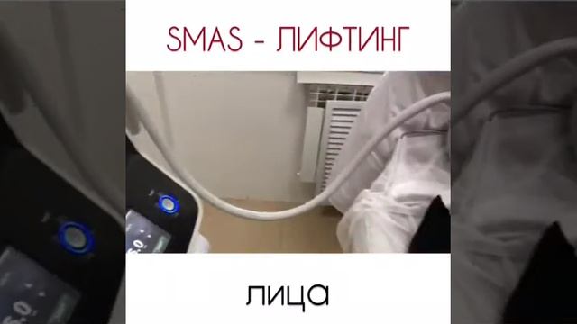 SMAS—лифтинг лица смотреть онлайн