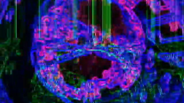 Trippy Visuals to Music; A result of my boredom смотреть онлайн