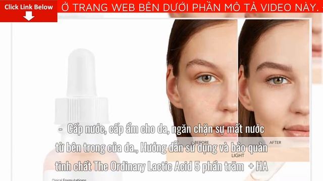 Review The Ordinary Lactic Acid 5% + HA Tinh Chất Tẩy Tế Bào Giá bao nhiêu? Mua ở đâu? Có tốt không смотреть онлайн