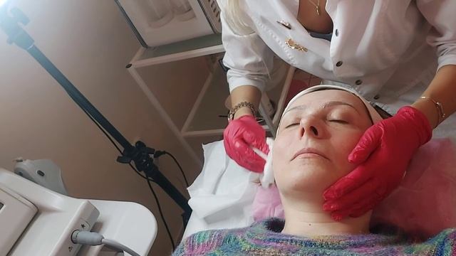 4 D SMAS Лифтинг лица. Ожидание и реальность))) смотреть онлайн