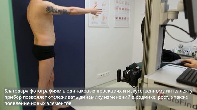 FotoFinder (Фотофайндер) в борьбе с раком кожи смотреть онлайн