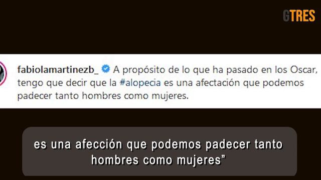 Fabiola Martínez sufre alopecia y lo muestra en sus redes sociales | Diez Minutos смотреть онлайн