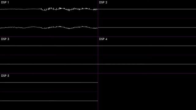 Heart of Nova [Kirby Super Star] | Oscilloscope + Deconstruction смотреть онлайн