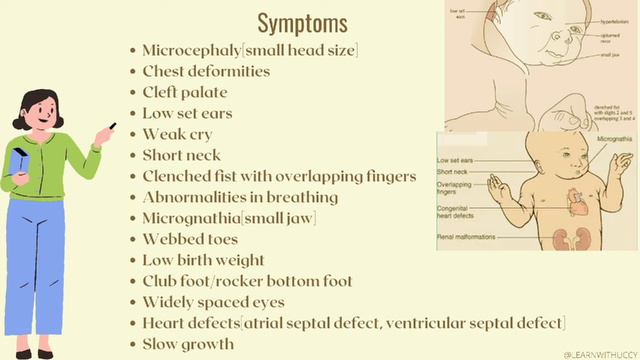 Edward's Syndrome(trisomy 18)-causes,symptoms and diagnosis смотреть онлайн