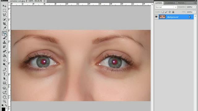 Odstranenie cervenych oci, Red eye reduction смотреть онлайн