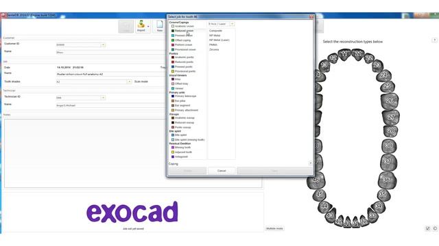 EXOCAD TUTORIAL Dental-CAD/CAM-FREE-FULL-MOVIE-The Exocad Orderlist-English by Michael Anger смотреть онлайн