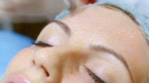 Как делают химический пилинг лица у косметолога