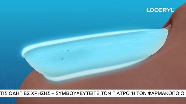 Loceryl | Άφησε ελεύθερα τα πόδια σου