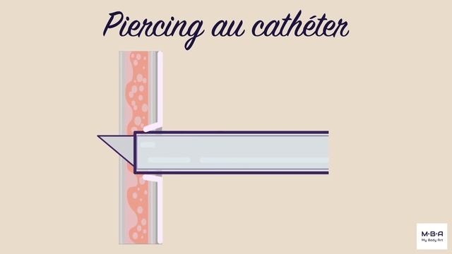 Piercing Catheter Vs. Needle Blade