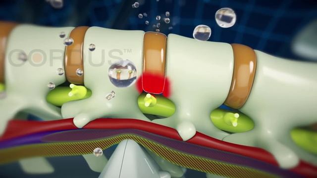 Treating Spinal Pains And Disc Herniation With Cordus