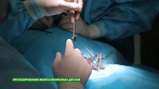 Протезирование межпозвонковых дисков с помощью эндопротеза М6 смотреть онлайн