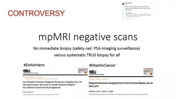 PI-RADS mpMRI-MRI Directed Biopsy Pathway 2019