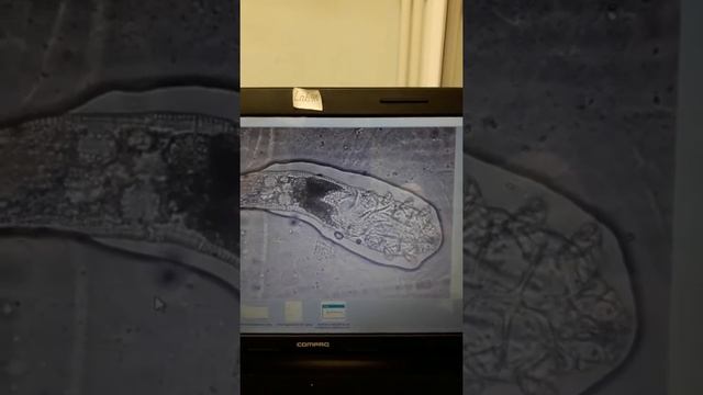 Демодекоз смотреть онлайн