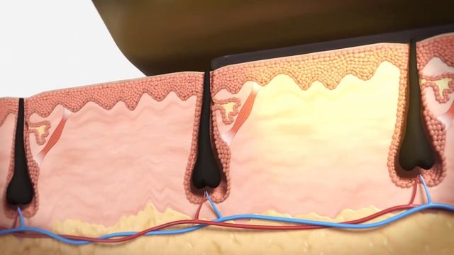 Laser Soprano Ice Platinum смотреть онлайн