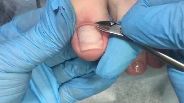 Блестящий педикюр,комби педикюр, дизайн. Brilliant Pedicure, Combined Pedicure, Design.