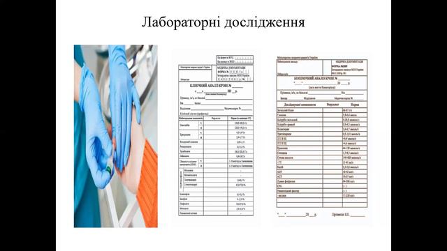 Перитоніт смотреть онлайн