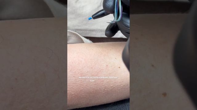 Как удалить волосы между процедурами ЭЭ? смотреть онлайн