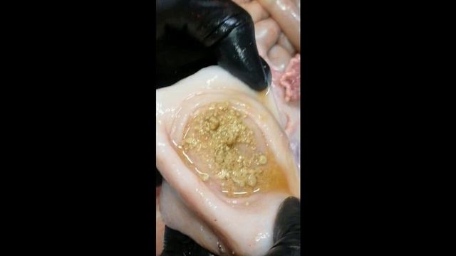 6 видео Циститы смотреть онлайн