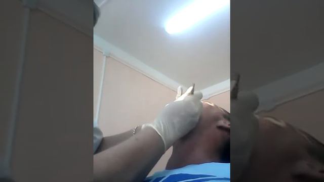 После этого я ездил ещё раз так как остался корень.и нужно ещё ехать опять остался корень. Беляевек смотреть онлайн