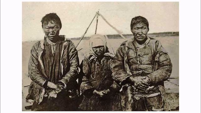 Колония прокаженных. Как в России узнали о лепре. смотреть онлайн
