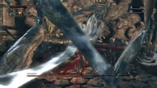 Bloodborne - Amygdala Boss - Amygdala Trophy - Chalice of Ailing Loran - Walkthrough Part 24 смотреть онлайн