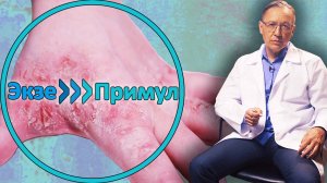 Как быстро и эффективно вылечить ЭКЗЕМУ?
