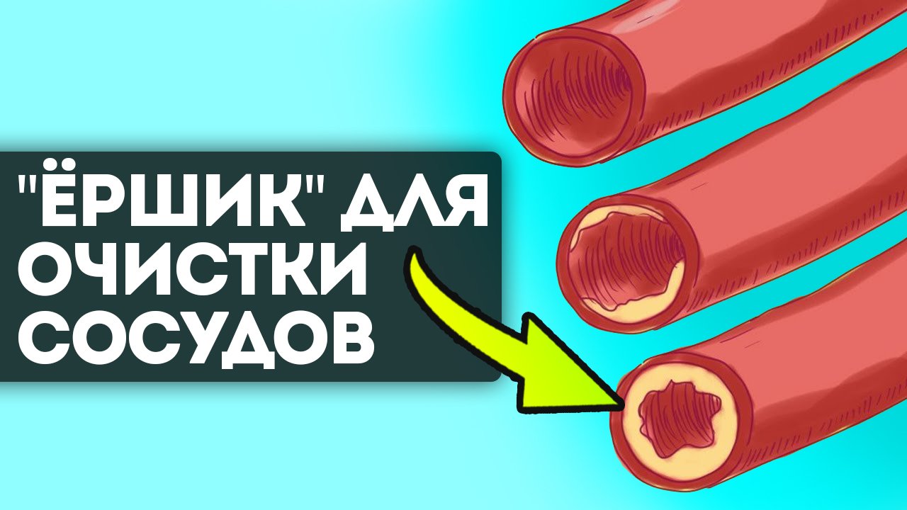 Эти продукты спасут сосуды после 50 лет! Как очистить сосуды и облегчить работу сердца смотреть онлайн