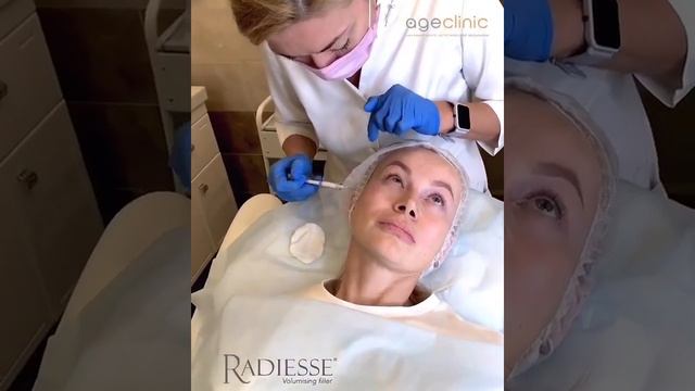 Векторный лифтинг RADIESSE смотреть онлайн