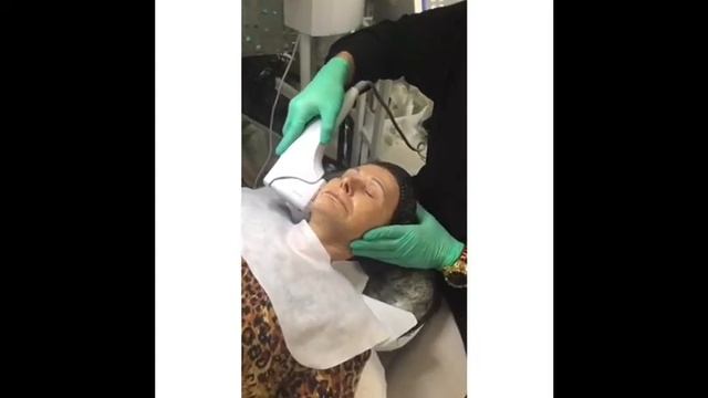 SMAS LIFTING FACIAL SIN CIRUGIA HIFU4D смотреть онлайн