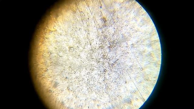 Под микроскопом #1 \ Инфузории \ Under the microscope #1 \ Protozoa смотреть онлайн