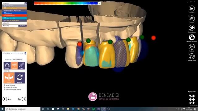 Introducción y trucos en Exocad смотреть онлайн