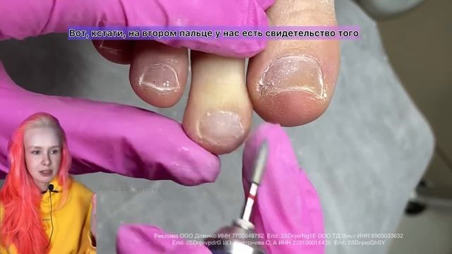 СЛОЖНЫЙ ПЕДИКЮР | ОБРАБОТКА НОГТЕЙ | КАК РАБОТАТЬ ФРЕЗОЙ #алена_лаврентьева #nails #ногти