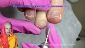 СЛОЖНЫЙ ПЕДИКЮР | ОБРАБОТКА НОГТЕЙ | КАК РАБОТАТЬ ФРЕЗОЙ #алена_лаврентьева #nails #ногти