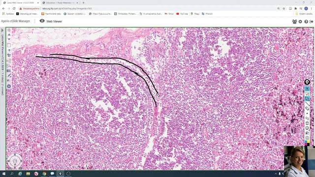 lymph node смотреть онлайн